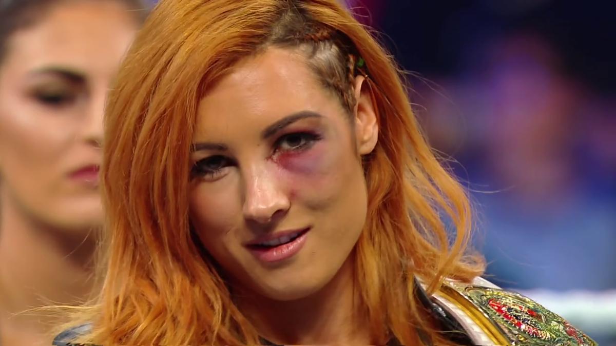 Becky Lynch with a black eye