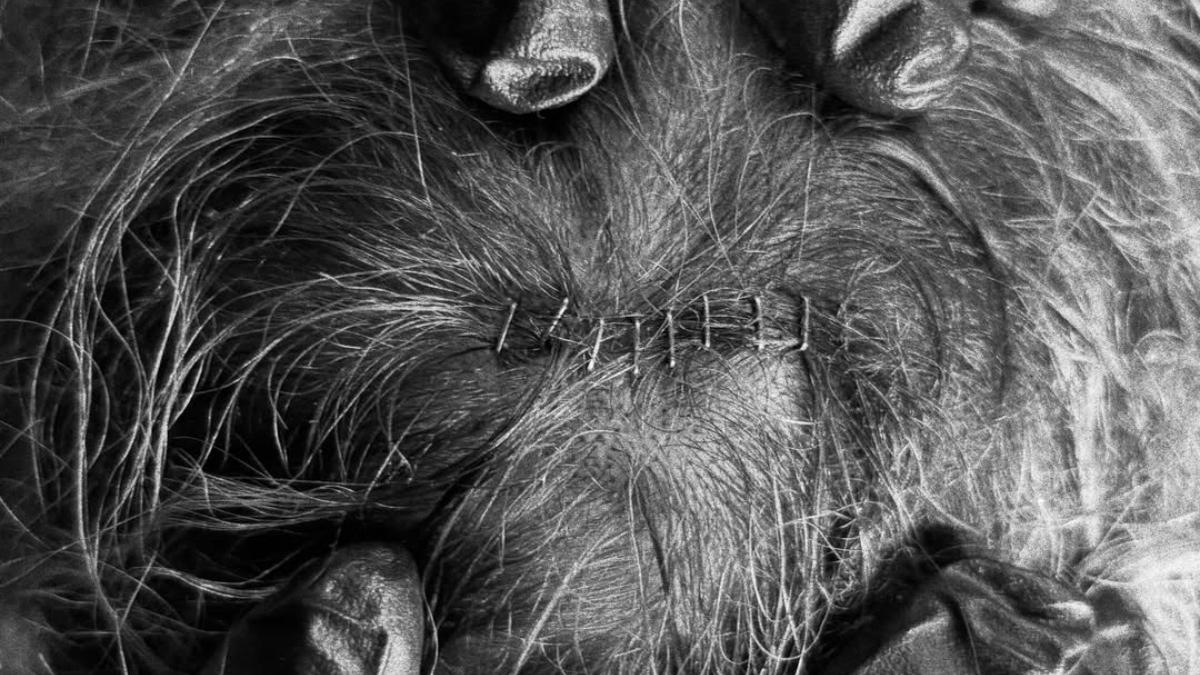 Black and white photo of eight staples in Sol Ruca's head